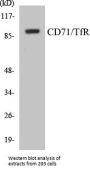 CD71/TfR Colorimetric Cell-Based ELISA Kit