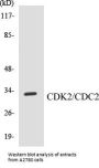 CDK2 Colorimetric Cell-Based ELISA Kit
