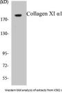 Collagen XI alpha1 Colorimetric Cell-Based ELISA Kit