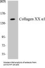 Collagen XX alpha1 Colorimetric Cell-Based ELISA Kit