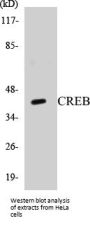CREB Colorimetric Cell-Based ELISA Kit