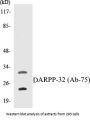 DARPP-32 Colorimetric Cell-Based ELISA Kit