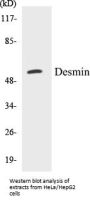 Desmin Colorimetric Cell-Based ELISA Kit