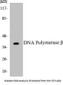 DNA Polymerase beta Colorimetric Cell-Based ELISA Kit