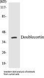 Doublecortin Colorimetric Cell-Based ELISA Kit