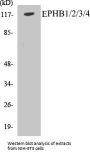 EPHB1/2/3/4 Colorimetric Cell-Based ELISA Kit
