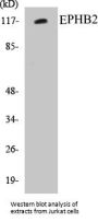 EPHB2 Colorimetric Cell-Based ELISA Kit