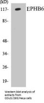 EPHB6 Colorimetric Cell-Based ELISA Kit