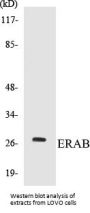 ERAB Colorimetric Cell-Based ELISA Kit