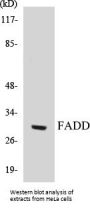 FADD Colorimetric Cell-Based ELISA Kit