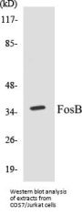 FosB Colorimetric Cell-Based ELISA Kit