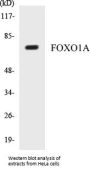 FOXO1A Colorimetric Cell-Based ELISA Kit