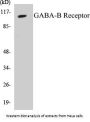 GABA-B Receptor Colorimetric Cell-Based ELISA Kit