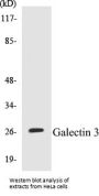 Galectin 3 Colorimetric Cell-Based ELISA Kit