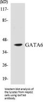 GATA6 Colorimetric Cell-Based ELISA Kit