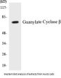 Guanylate Cyclase beta Colorimetric Cell-Based ELISA Kit