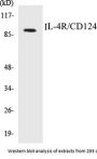 IL-4R/CD124 Colorimetric Cell-Based ELISA Kit