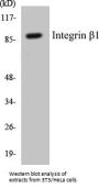 Integrin beta1 Colorimetric Cell-Based ELISA Kit