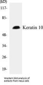Keratin 10 Colorimetric Cell-Based ELISA Kit