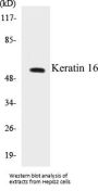 Keratin 16 Colorimetric Cell-Based ELISA Kit