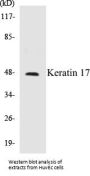 Keratin 17 Colorimetric Cell-Based ELISA Kit