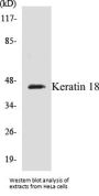 Keratin 18 Colorimetric Cell-Based ELISA Kit