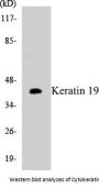 Keratin 19 Colorimetric Cell-Based ELISA Kit
