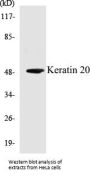 Keratin 20 Colorimetric Cell-Based ELISA Kit
