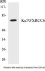 Ku70/XRCC6 Colorimetric Cell-Based ELISA Kit