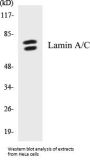Lamin A/C Colorimetric Cell-Based ELISA Kit