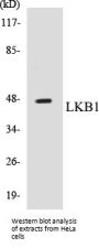 LKB1 Colorimetric Cell-Based ELISA Kit