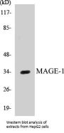 MAGE-1 Colorimetric Cell-Based ELISA Kit