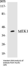 MEK1 Colorimetric Cell-Based ELISA Kit