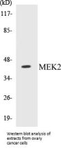 MEK2 Colorimetric Cell-Based ELISA Kit
