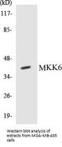 MKK6 Colorimetric Cell-Based ELISA Kit