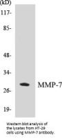 MMP-7 Colorimetric Cell-Based ELISA Kit