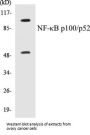 NF-kappaB p100/p52 Colorimetric Cell-Based ELISA Kit