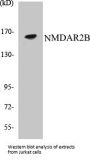 NMDAR2B Colorimetric Cell-Based ELISA Kit