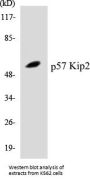 p57 Kip2 Colorimetric Cell-Based ELISA Kit