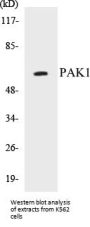 PAK1 Colorimetric Cell-Based ELISA Kit