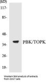 PBK/TOPK Colorimetric Cell-Based ELISA Kit
