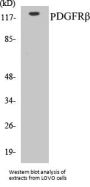 PDGFRbeta Colorimetric Cell-Based ELISA Kit