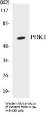 PDK1 Colorimetric Cell-Based ELISA Kit