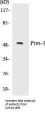 Pim-1 Colorimetric Cell-Based ELISA Kit