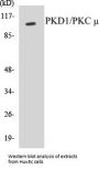 PKD1/PKC mu Colorimetric Cell-Based ELISA Kit