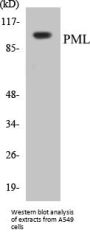 PML Colorimetric Cell-Based ELISA Kit