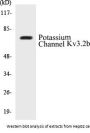 Potassium Channel Kv3.2b Colorimetric Cell-Based ELISA Kit