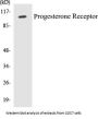 Progesterone Receptor Colorimetric Cell-Based ELISA Kit