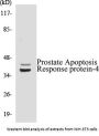 Prostate Apoptosis Response protein-4 Colorimetric Cell-Based ELISA Kit