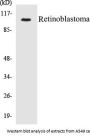 Retinoblastoma Colorimetric Cell-Based ELISA Kit